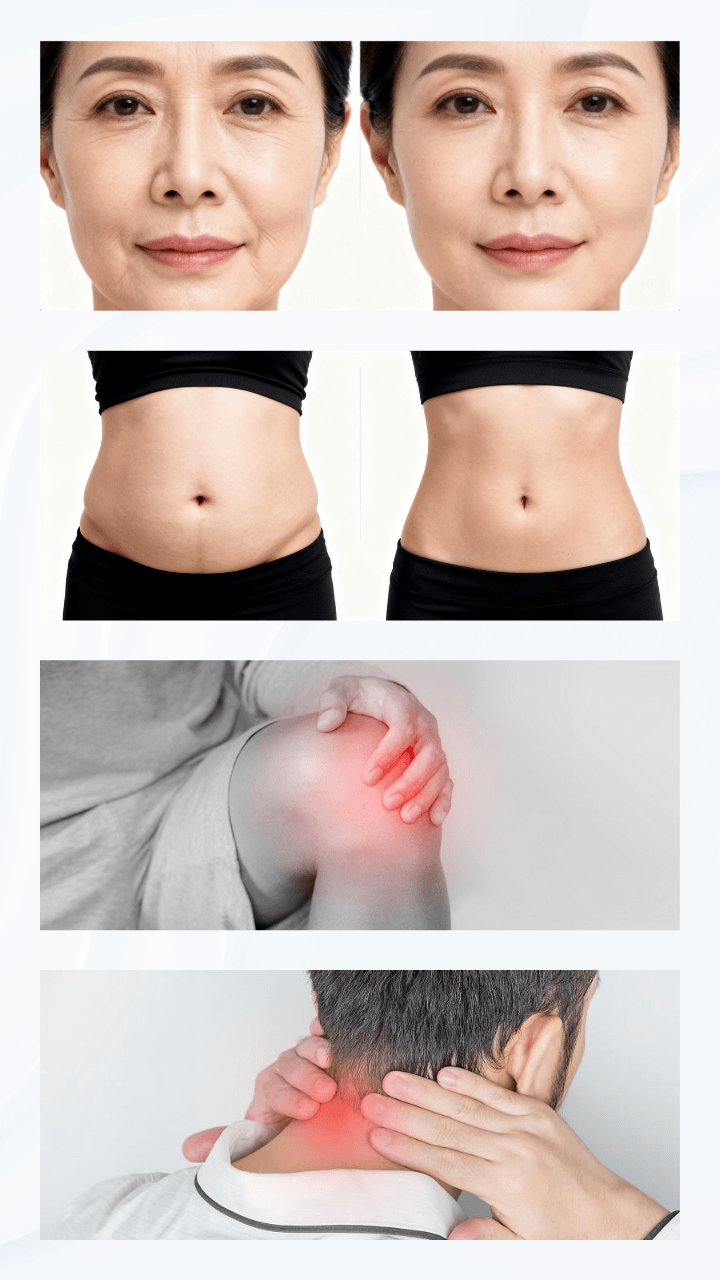 Before and after results of RF Body and Face Skin Lifting Treatment, showing improved skin tightening and contouring